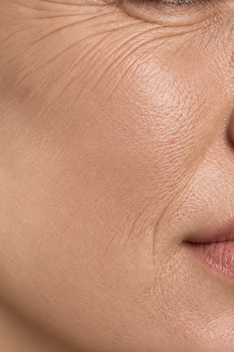 Anti-Aging