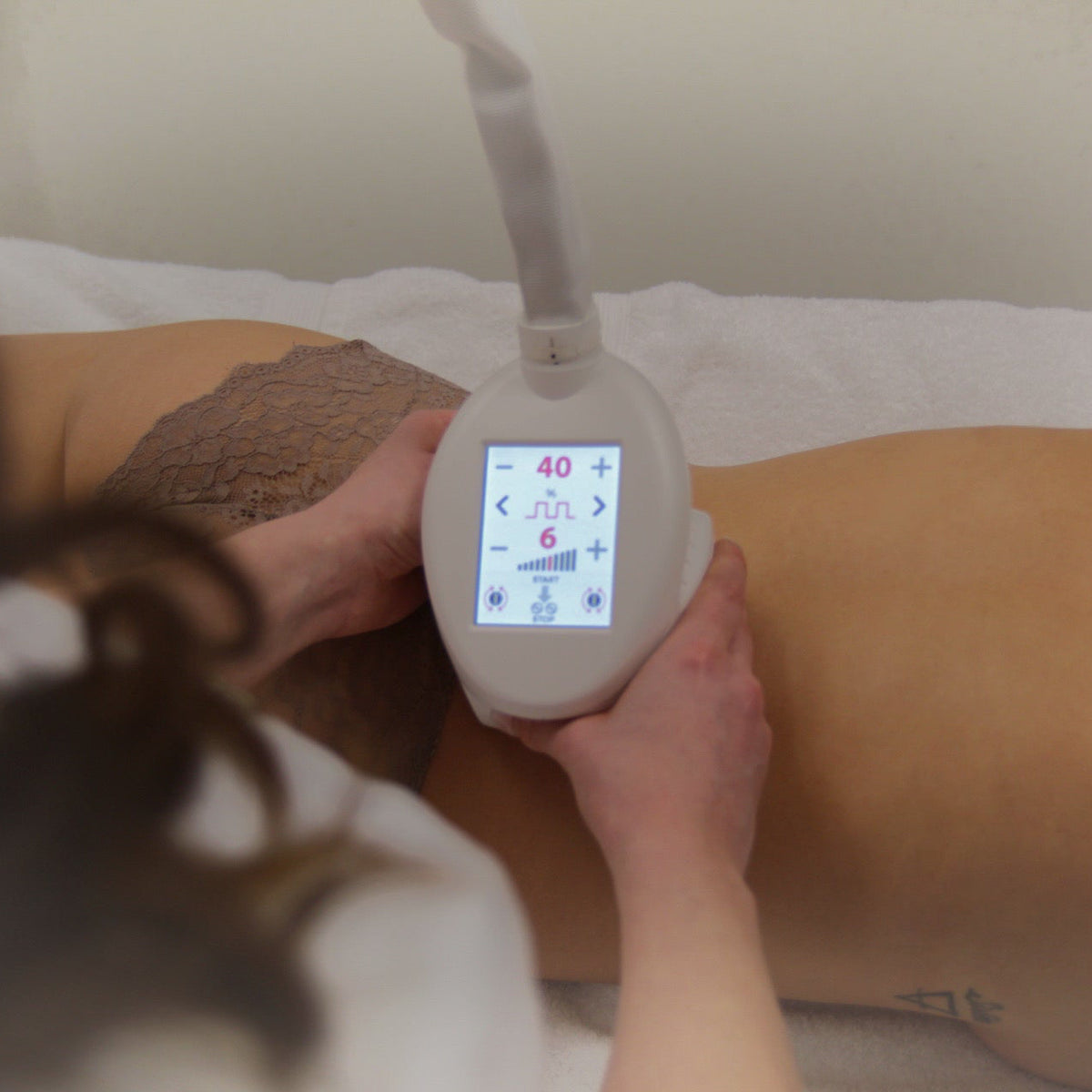 icoone® Laserbehandlung für straffere Haut bei JU’KISS